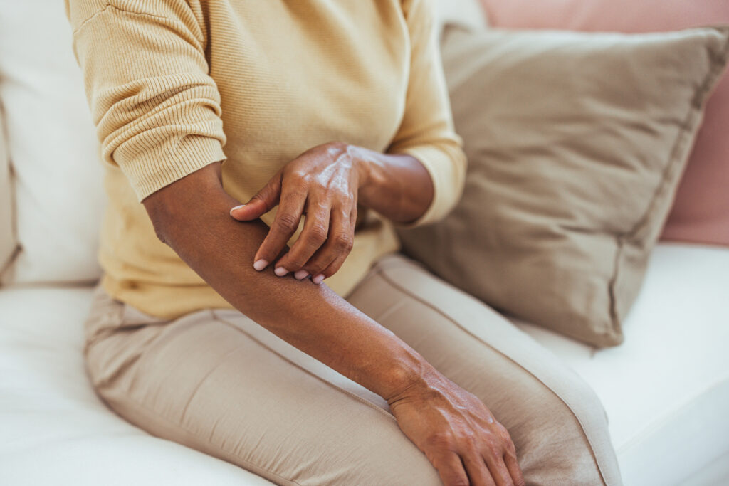 Sanofi and Regeneron Expand Dupixent Benefits for Eczema in Darker Skin Tones