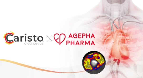 Cardio Diagnostics Teams Up with AGEPHA Pharma to Advance CHD Treatment with LODOCO®