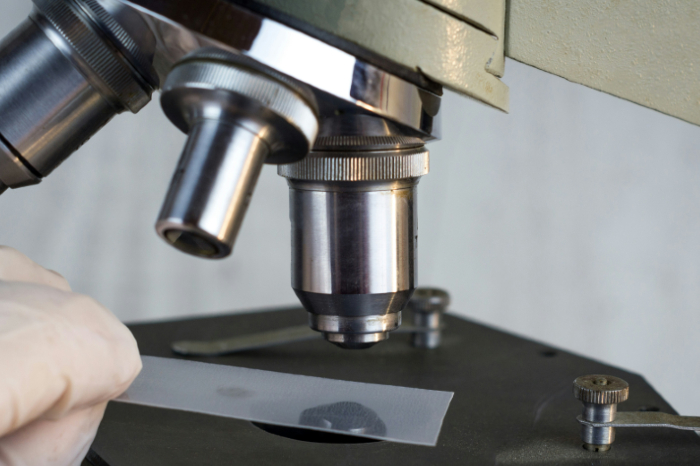 Inventiva Appoints New Leaders to Strengthen MASH Drug Development
