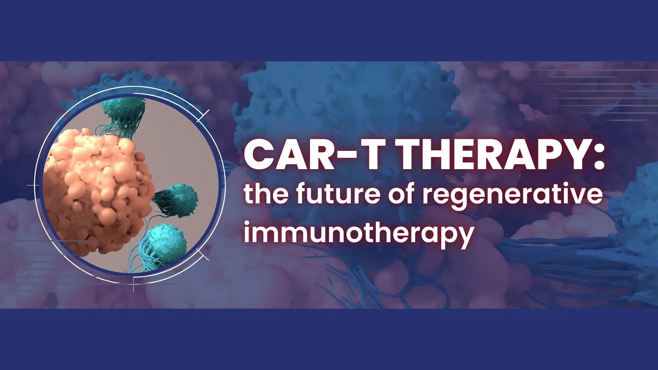 CAR T therapies approach for AI