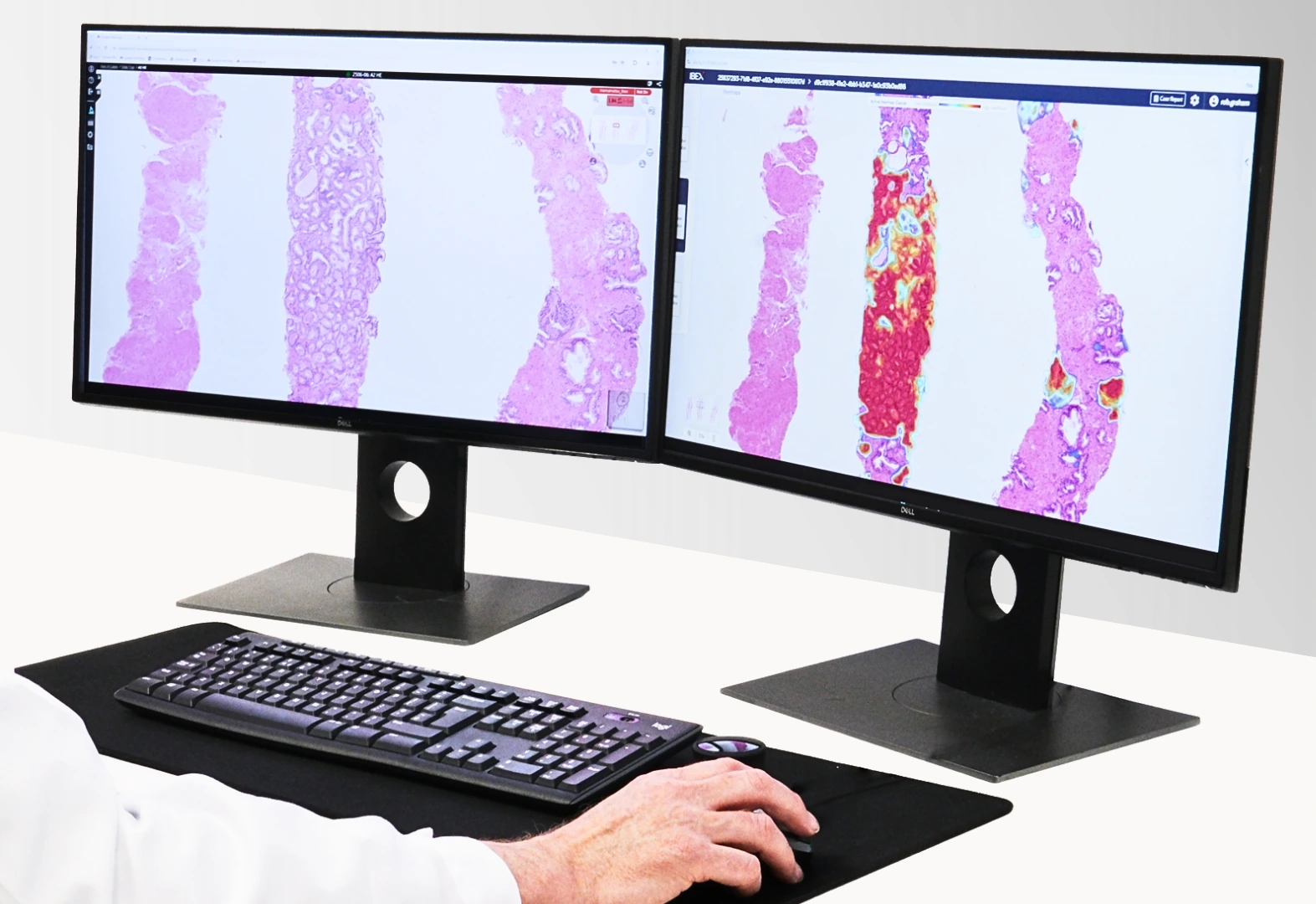 FUJIFILM Healthcare Europe and Ibex Partner to Transform Cancer Diagnostics with AI