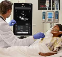 FUJIFILM VisualSonics Launches Smart Photoacoustic Imaging Platform for Preclinical Research