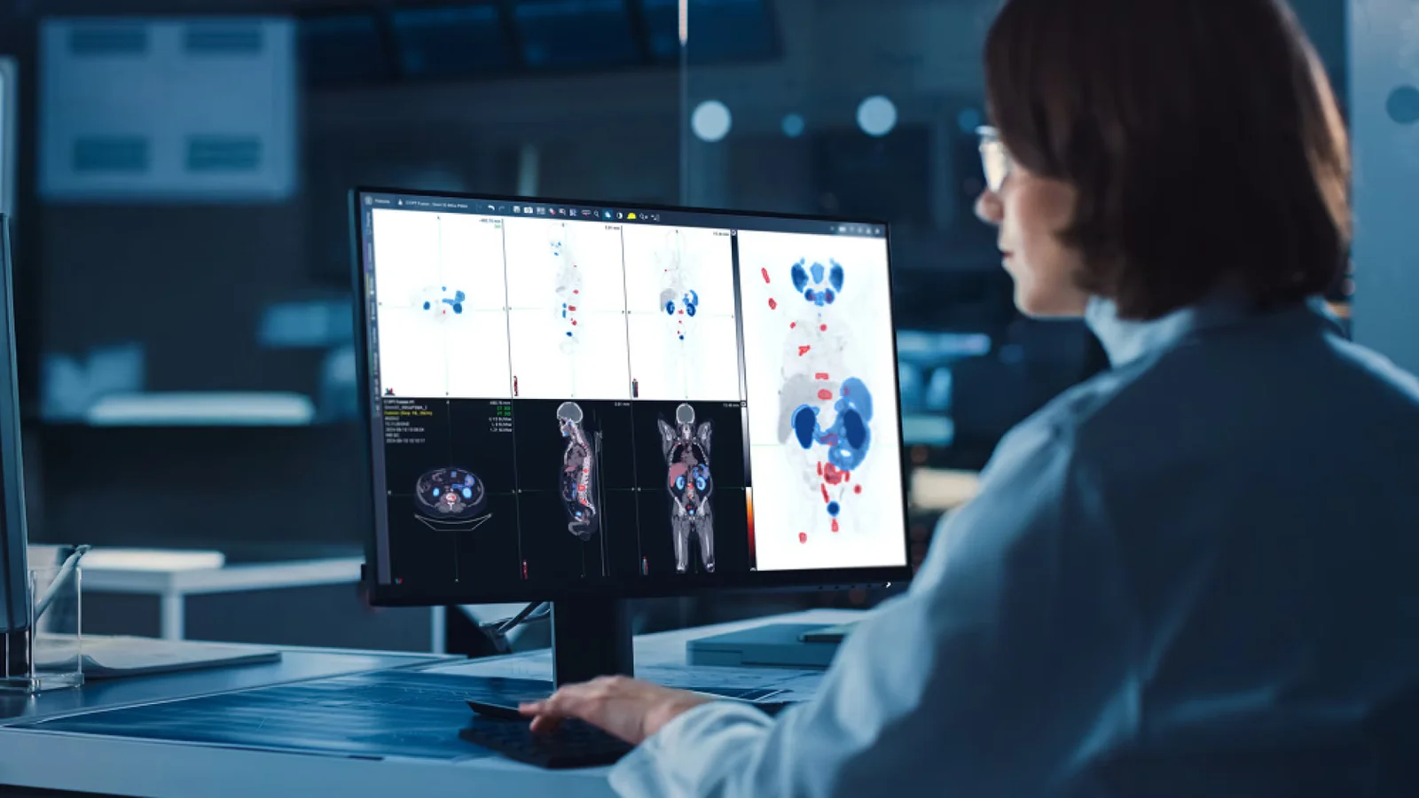 GE Healthcare Unveils AI-Powered Theranostics Software to Boost Cancer Diagnosis and Treatment