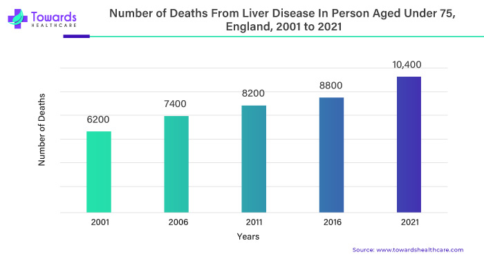 Number of Deaths from Liver Disease in Person Aged Under 75, England, 2001 to 2021