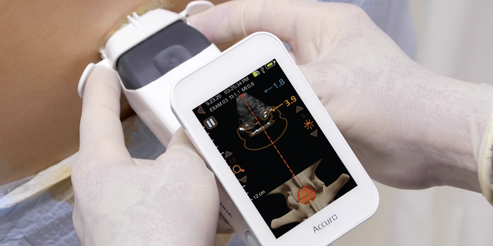 Rivanna Joins Medtech Innovator 2025 Cohort with Groundbreaking Ultrasound Tech